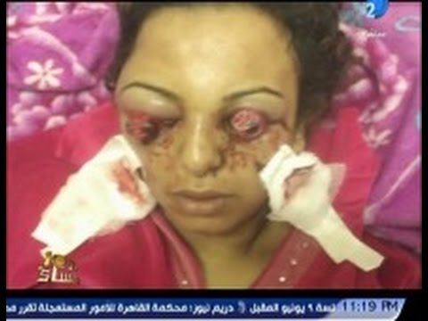 شاهد رجل يعذب زوجته ويفقأ عينيها بسبب خطبة دينية